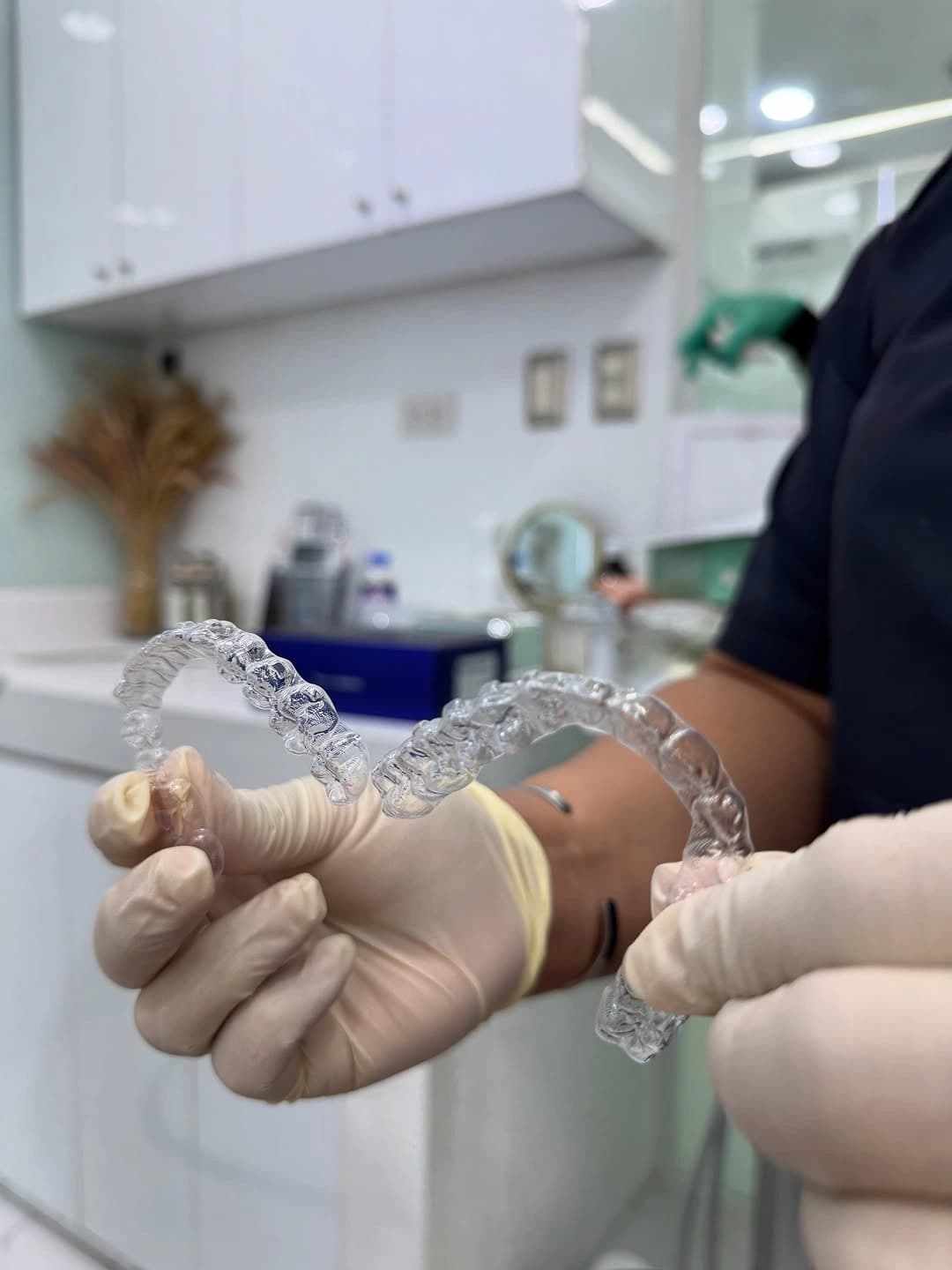 Treatment Planning for Direct-Printed, Graphy, and Thermoformed Aligners